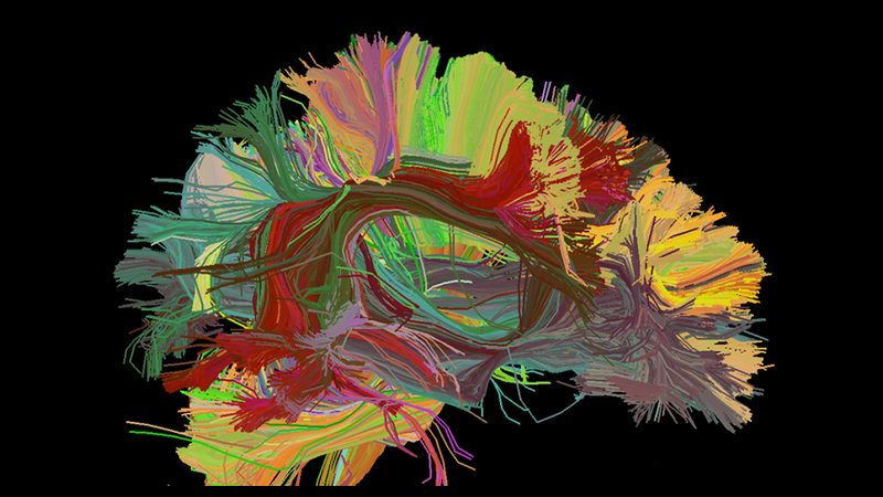 Whole-brain tractography rendered with DIPY